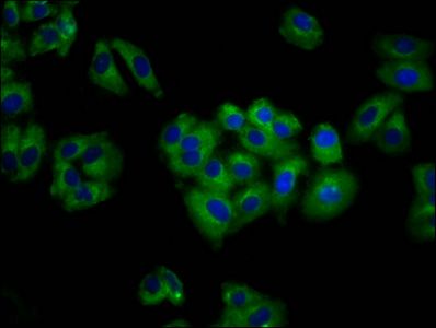 ANO6 Antibody