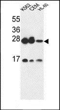 ANP32A antibody