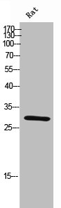 ANP32B Antibody