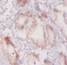 GRK2 Antibody