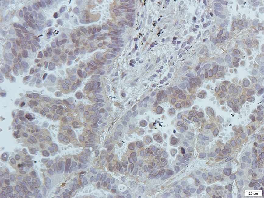 Antigen KI-67 Rabbit Polyclonal Antibody