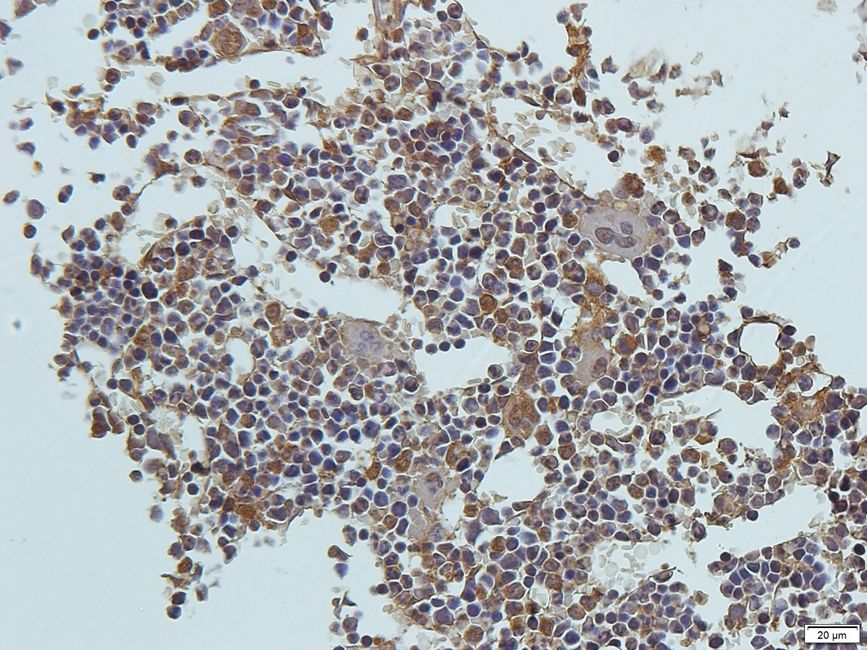 Antigen KI-67 Rabbit Polyclonal Antibody
