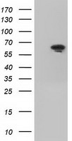 Antithrombin III (SERPINC1) Mouse Monoclonal Antibody [Clone ID: OTI8D5]