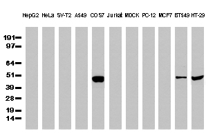 Antizyme inhibitor 1 (AZIN1) Mouse Monoclonal Antibody [Clone ID: OTI1G8]