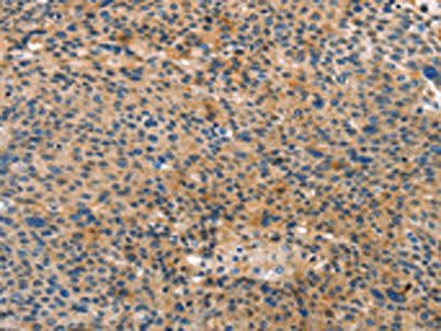 ANXA10 Antibody