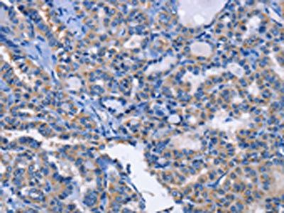 ANXA4 antibody