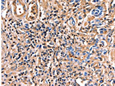 ANXA6 Antibody