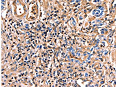 ANXA6 antibody