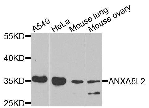 ANXA8L2 antibody