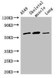 AOAH Antibody