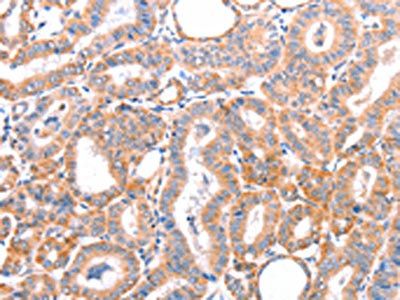 AOC1 antibody