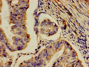 AOC3 Antibody