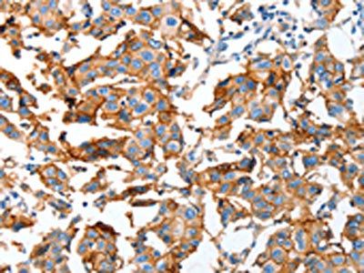 AOX1 Antibody