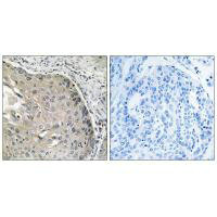 AOX1 Antibody