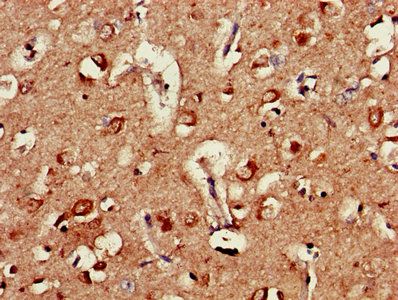AP2M1 Antibody