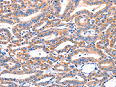 AP1B1 Antibody