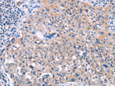 AP1B1 Antibody
