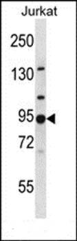 AP1G2 antibody