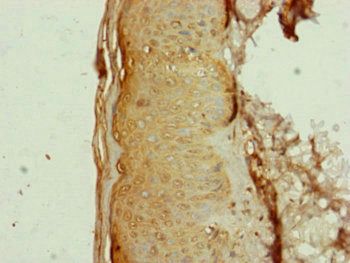 AP1M1 antibody