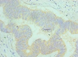 AP2M1 Antibody