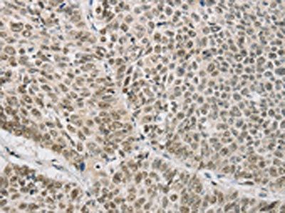 AP2M1 Antibody