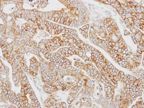 AP2M1 Rabbit Polyclonal Antibody