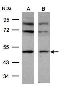 AP2M1 Rabbit Polyclonal Antibody