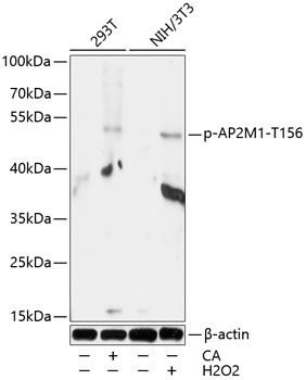 AP2M1 (Phospho-T156) antibody
