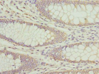 AP3B1 Antibody