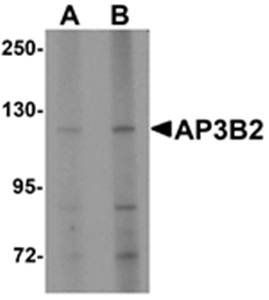 AP3B2 Antibody