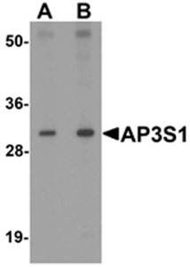 AP3S1 Antibody