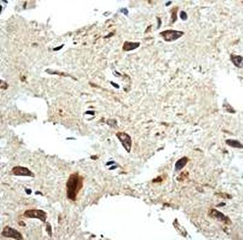 AP3S1 Rabbit Polyclonal Antibody