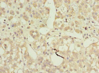 AP4B1 Antibody