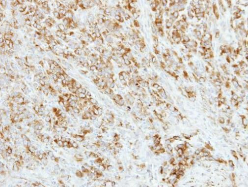 AP4M1 antibody