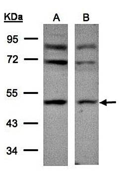 AP-2M1 antibody