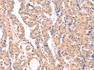 APBA2 Antibody