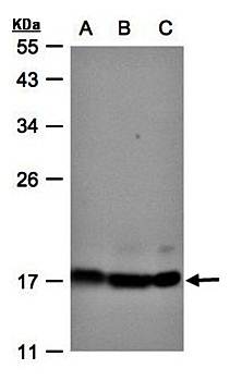 ATP synthase H+ transporting mitochondrial F1 complex delta subunit precursor antibody