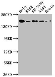 APC antibody