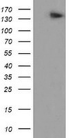 Apc11 Antibody