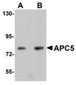 APC5 Antibody