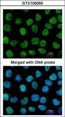 APE1 Rabbit Polyclonal Antibody