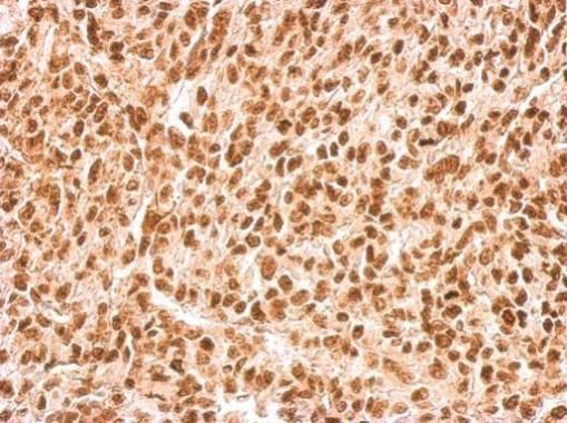 APE1 Rabbit Polyclonal Antibody