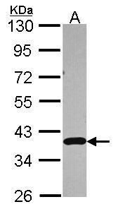 APE1 Rabbit Polyclonal Antibody