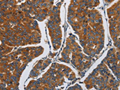 APEH Antibody