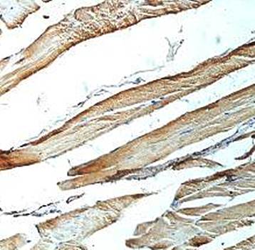 APEH Rabbit Polyclonal Antibody