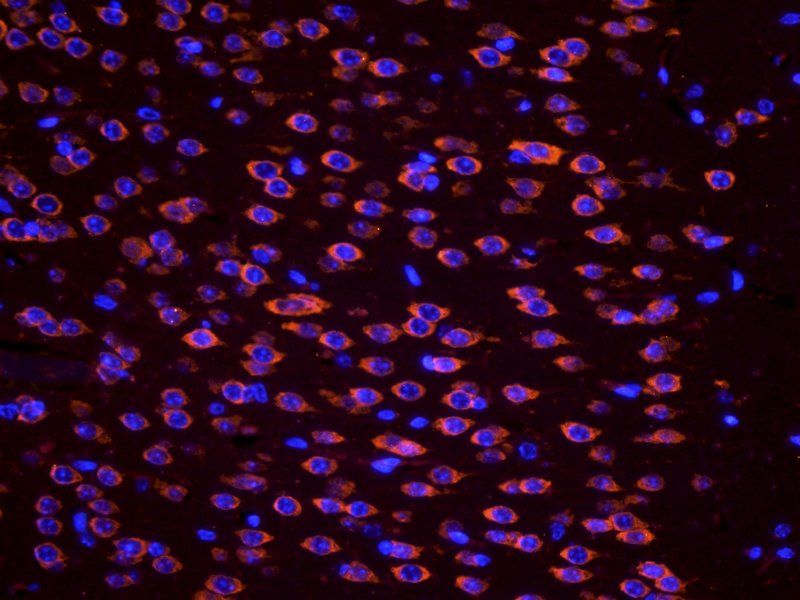Apelin Rabbit Polyclonal Antibody