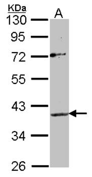Apelin receptor antibody