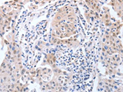 APEX1 Antibody