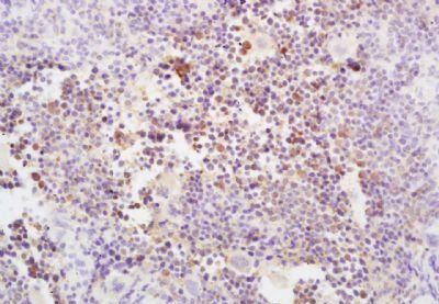 Aph-1b Rabbit Polyclonal Antibody