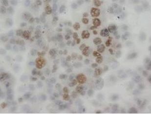 Anti-Apoptosis inhibitor 5/API5 Antibody